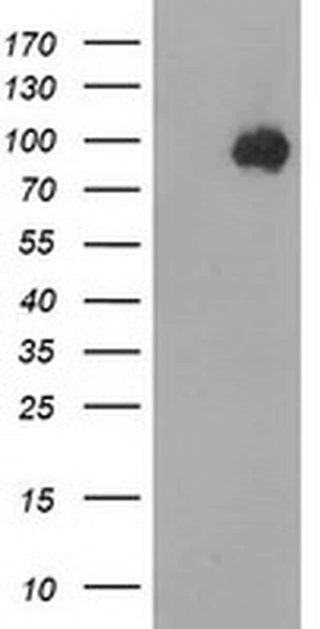 Beta-catenin Antibody in Western Blot (WB)