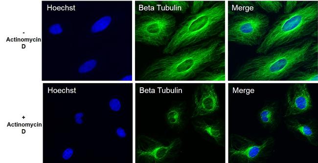 beta Tubulin Loading Control Antibody in Immunocytochemistry (ICC/IF)