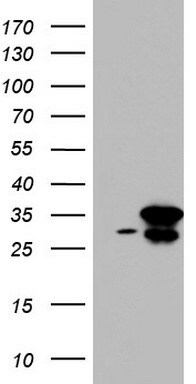 RTRAF Antibody in Western Blot (WB)
