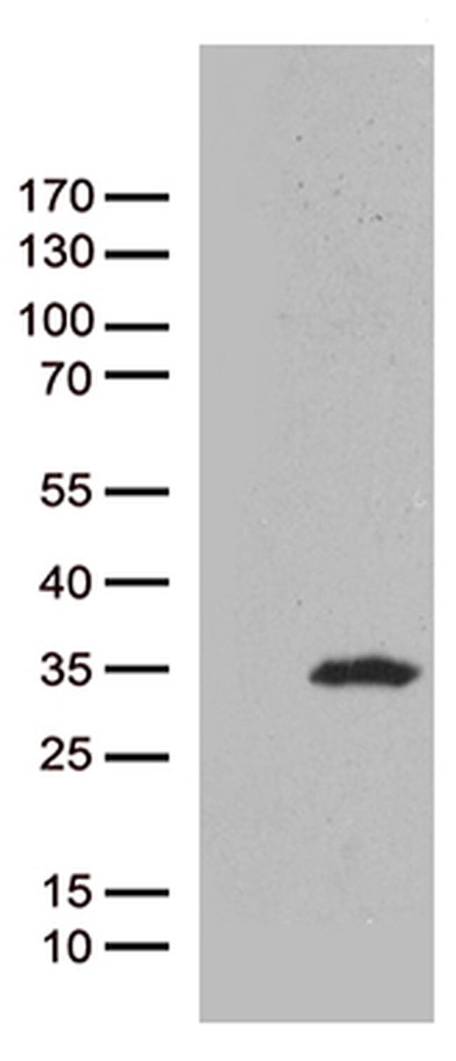 CAV1 Antibody in Western Blot (WB)