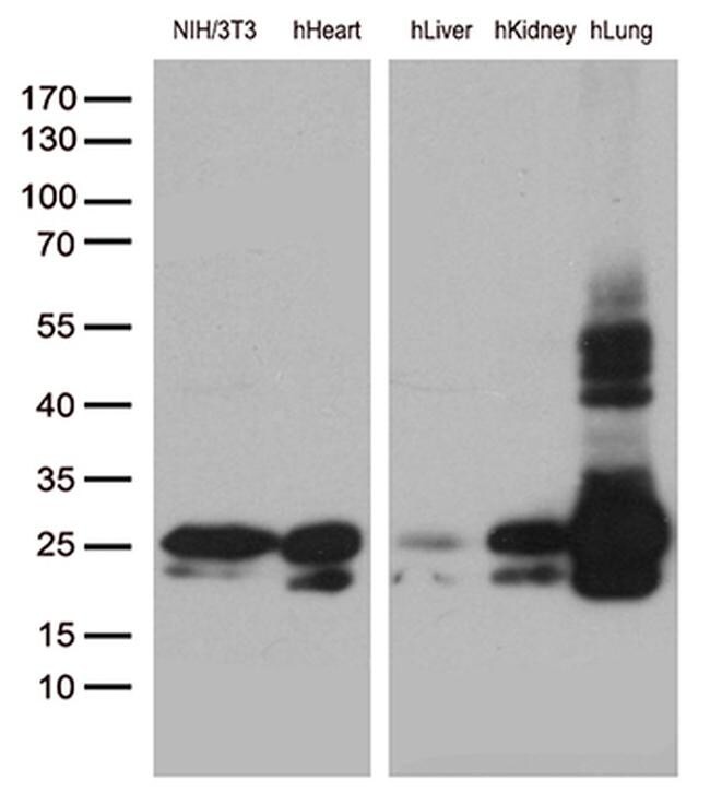 CAV1 Antibody in Western Blot (WB)