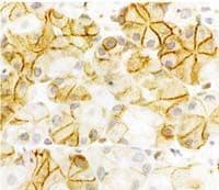 CCKAR Antibody in Immunohistochemistry (IHC)