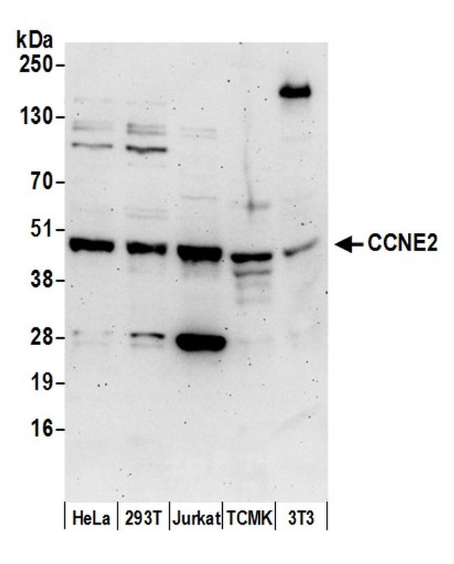 CCNE2/Cyclin E2 Polyclonal Antibody