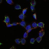 CD105 Antibody (MA5-17041)