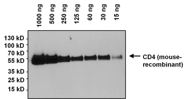 CD4 Antibody in Western Blot (WB)