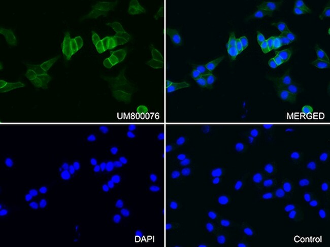 CDH1 Antibody in Immunocytochemistry (ICC/IF)