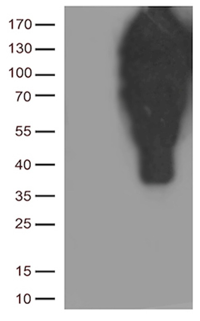 CDH1 Antibody in Western Blot (WB)