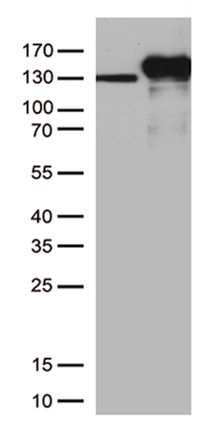 CDH2 Antibody in Western Blot (WB)