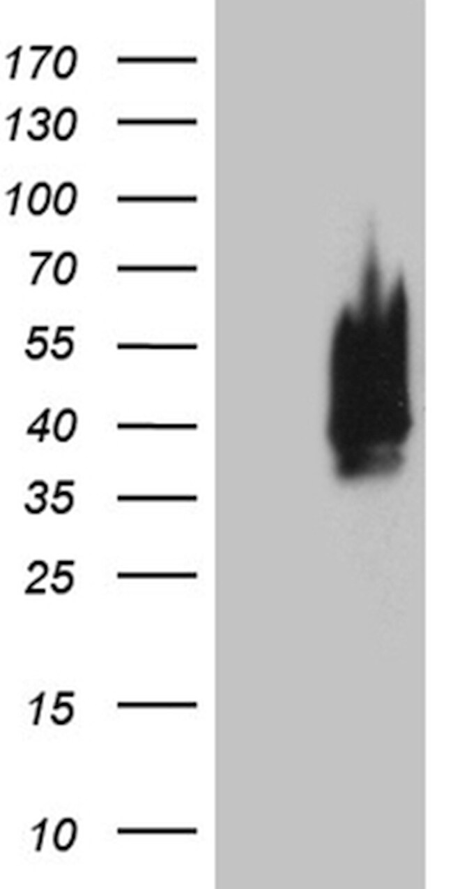 CDX1 Antibody in Western Blot (WB)