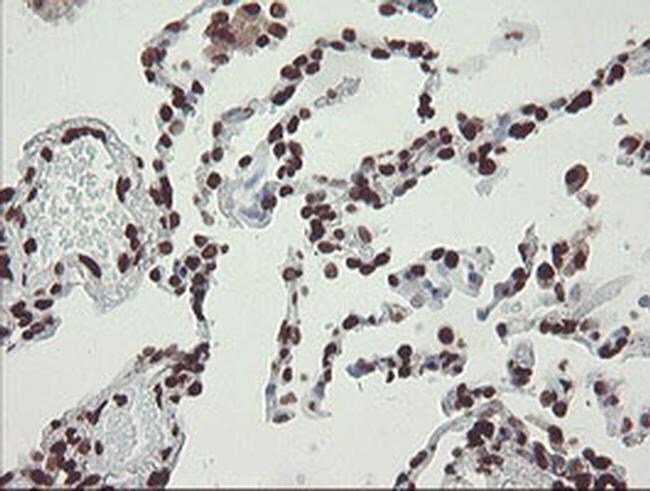 CHN1 Antibody in Immunohistochemistry (Paraffin) (IHC (P))