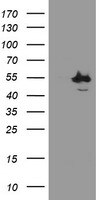 CHN1 Antibody in Western Blot (WB)