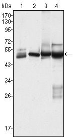 Cytokeratin 7 Antibody Ma5 15604