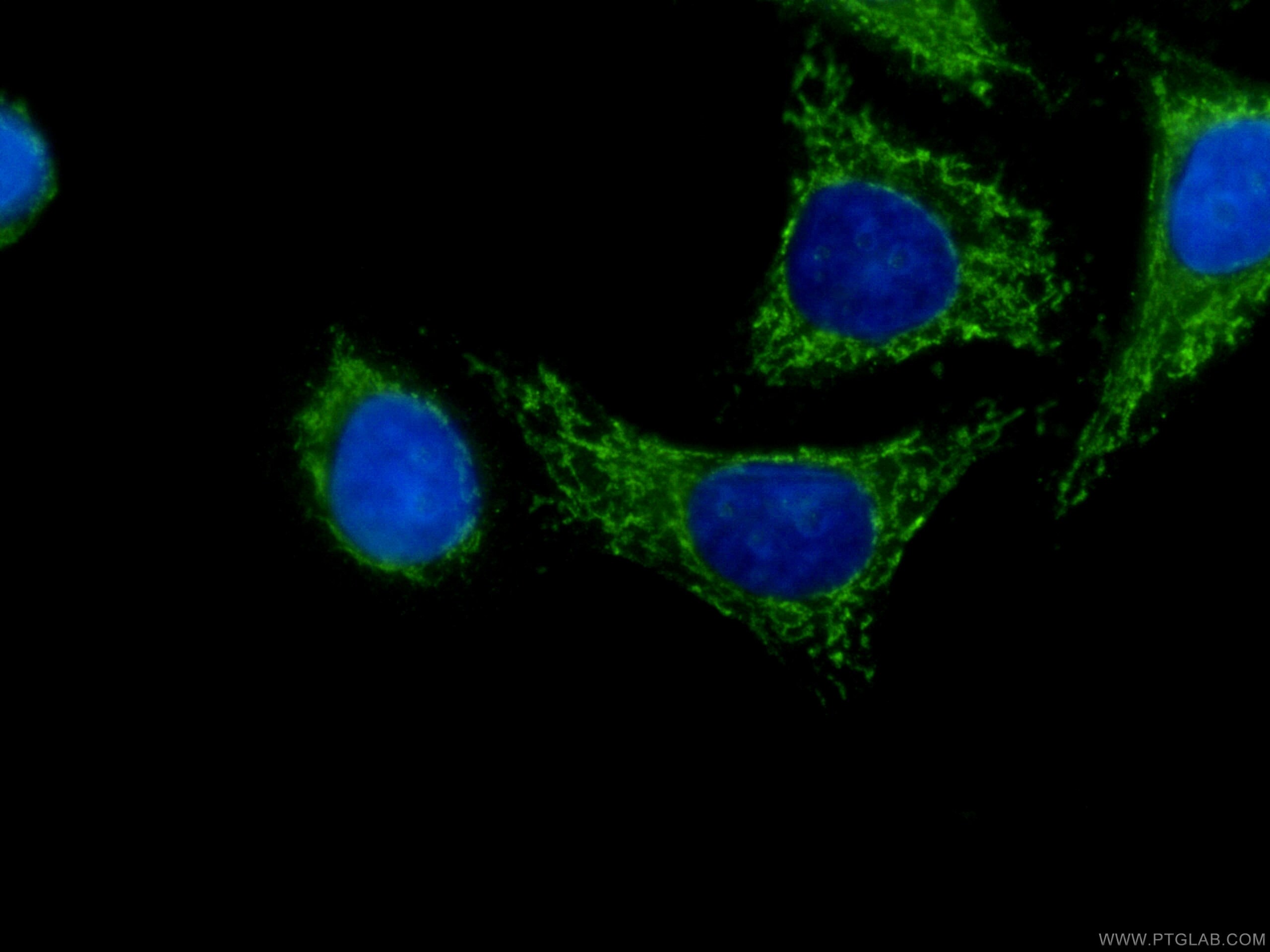 SERPINA10 Antibody in Immunocytochemistry (ICC/IF)