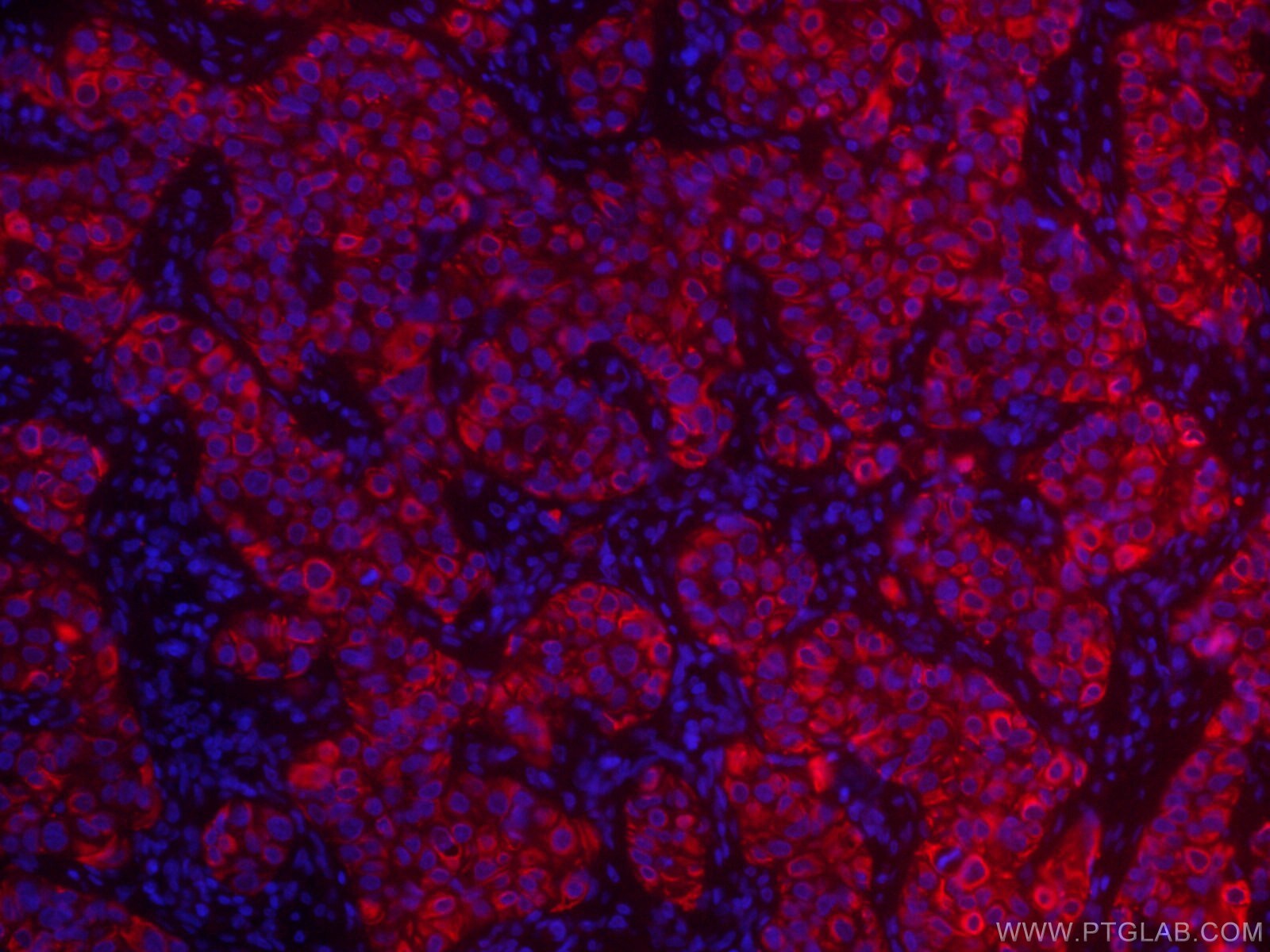 TNF alpha Antibody, CoraLite®594 (CL594-60291)