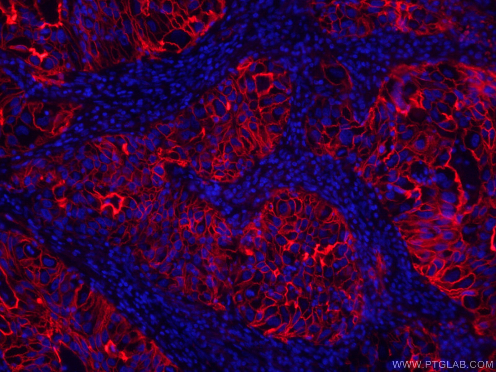 ICAM-1 Antibody, CoraLite®594 (CL594-60299)