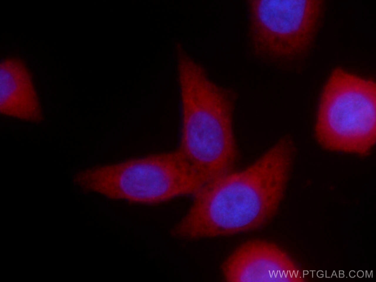 PKC iota Antibody in Immunocytochemistry (ICC/IF)