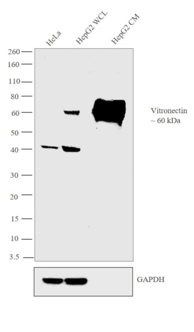 Vitronectin Antibody in Western Blot (WB)