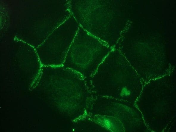 CDH11 Antibody in Immunocytochemistry (ICC/IF)