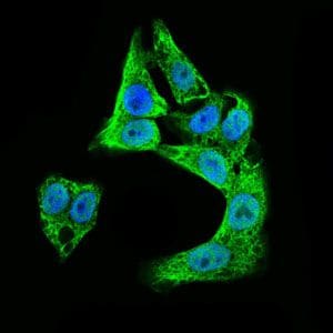 Doublecortin Antibody (MA5-17066)