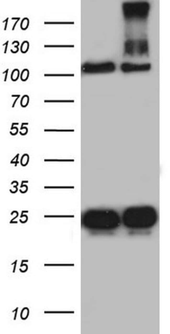 DOCK8 Antibody in Western Blot (WB)