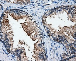 ELAVL1 Antibody in Immunohistochemistry (Paraffin) (IHC (P))