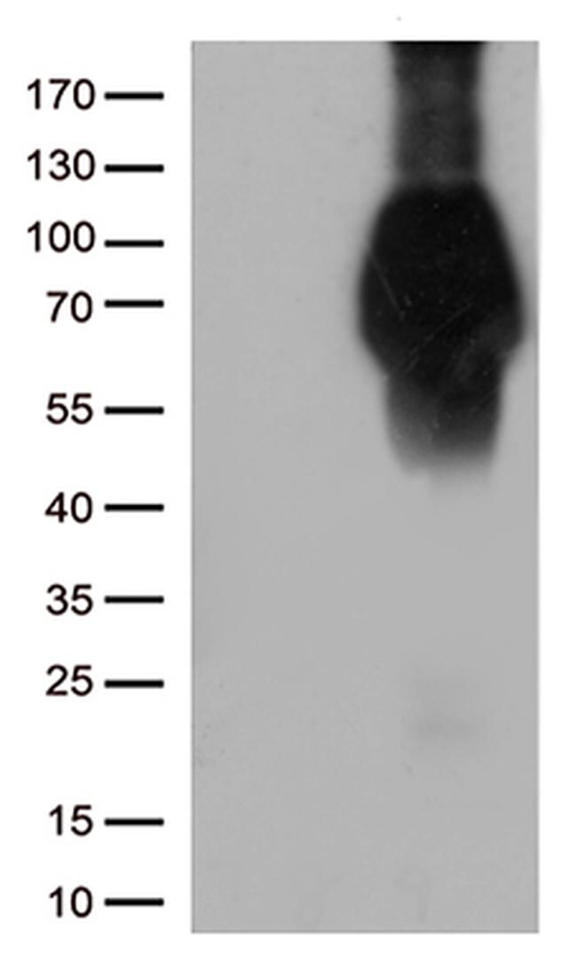 FCGR1A Antibody in Western Blot (WB)