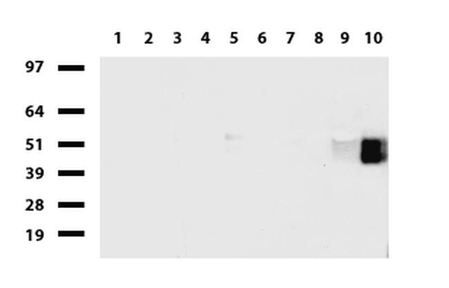 FCGR1A Antibody in Western Blot (WB)