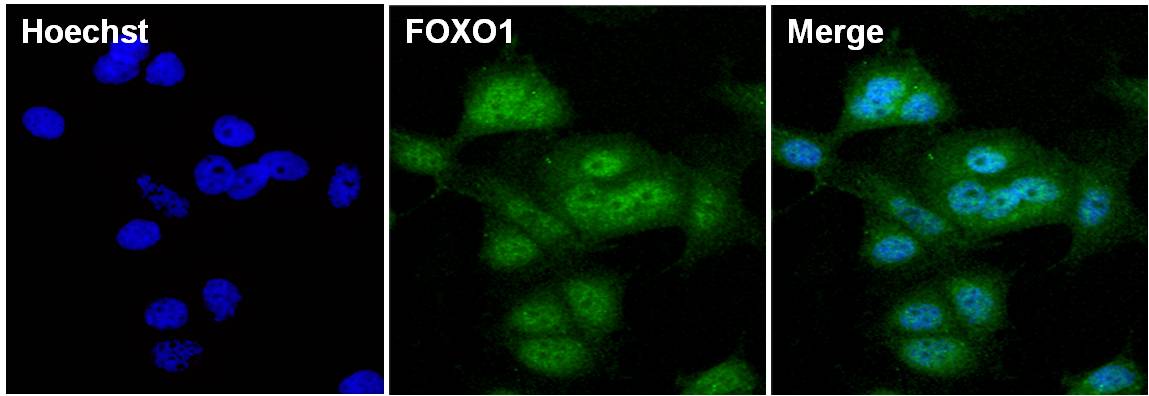 FOXO1 Antibody in Immunocytochemistry (ICC/IF)