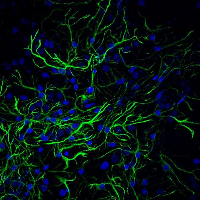 GFAP Antibody (MA5-12023)