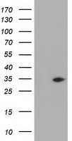 GGPS1 Antibody in Western Blot (WB)