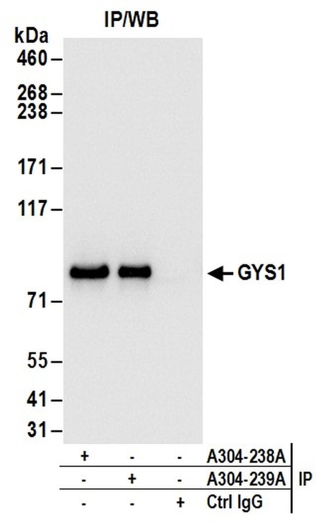 GYS1 Antibody (A304-238A)