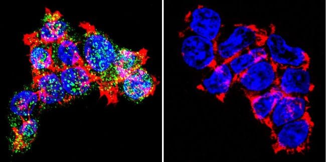 Glucocorticoid Receptor Antibody in Immunocytochemistry (ICC/IF)