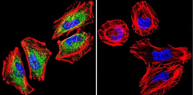 Glucocorticoid Receptor Antibody in Immunocytochemistry (ICC/IF)