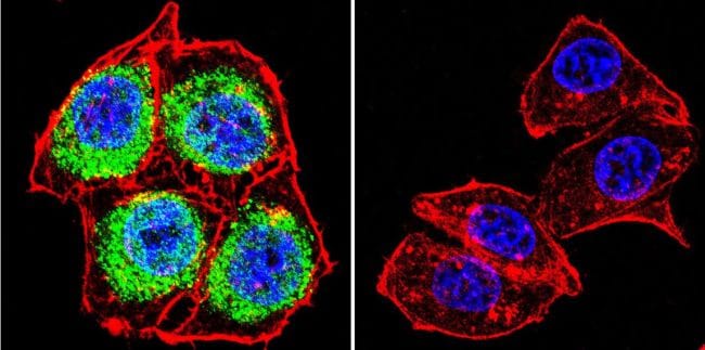 Glucocorticoid Receptor Antibody in Immunocytochemistry (ICC/IF)