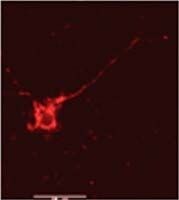 Phospho-NMDAR2B (Tyr1336) Antibody in Immunohistochemistry (IHC)