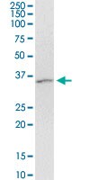 ARRB2 Antibody in Western Blot (WB)