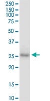 CDX1 Antibody in Western Blot (WB)