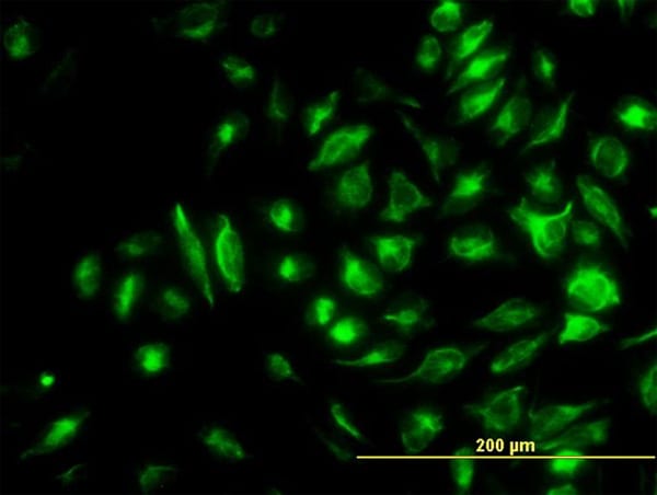 NME2 Antibody (H00004831-M06)