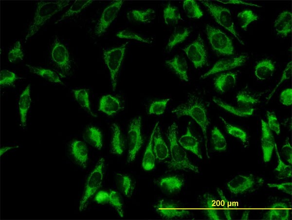 TOMM20 Antibody (H00009804-M01)