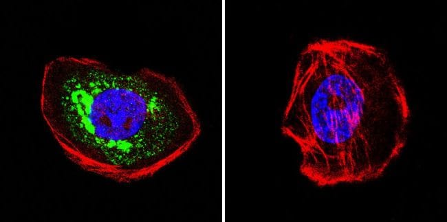 HIP Antibody in Immunocytochemistry (ICC/IF)