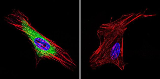 HIP Antibody in Immunocytochemistry (ICC/IF)