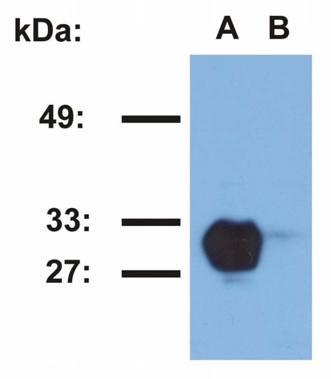 Hla dr1 antibody ma1 19393 