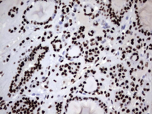 HNRNPM Antibody in Immunohistochemistry (Paraffin) (IHC (P))