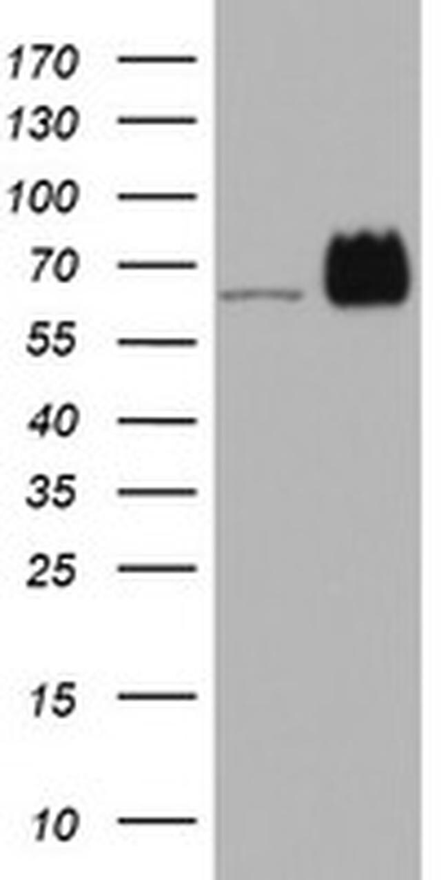 HNRNPM Antibody in Western Blot (WB)