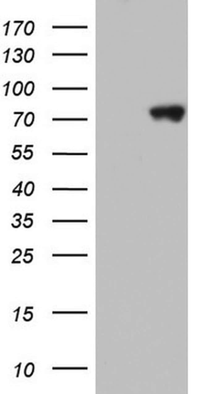 HNRNPM Antibody in Western Blot (WB)