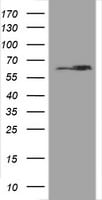 Hsp60 (HSPD1) Antibody in Western Blot (WB)