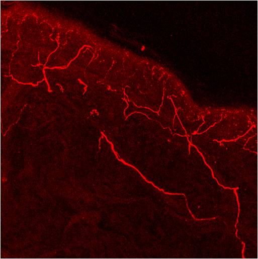 TRPV1 Antibody in Immunohistochemistry (Frozen) (IHC (F))