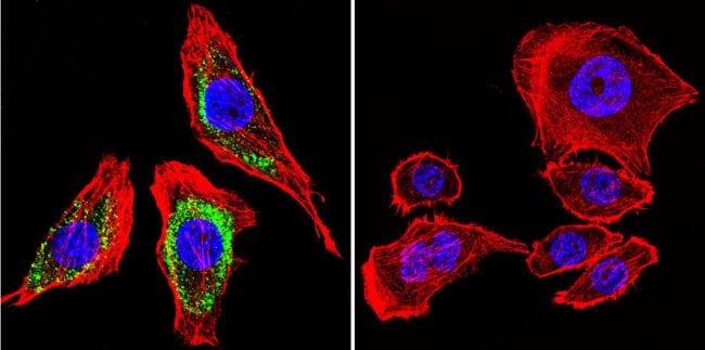 ATP4B Antibody in Immunocytochemistry (ICC/IF)