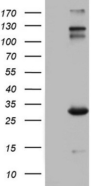 IGSF11 Antibody in Western Blot (WB)
