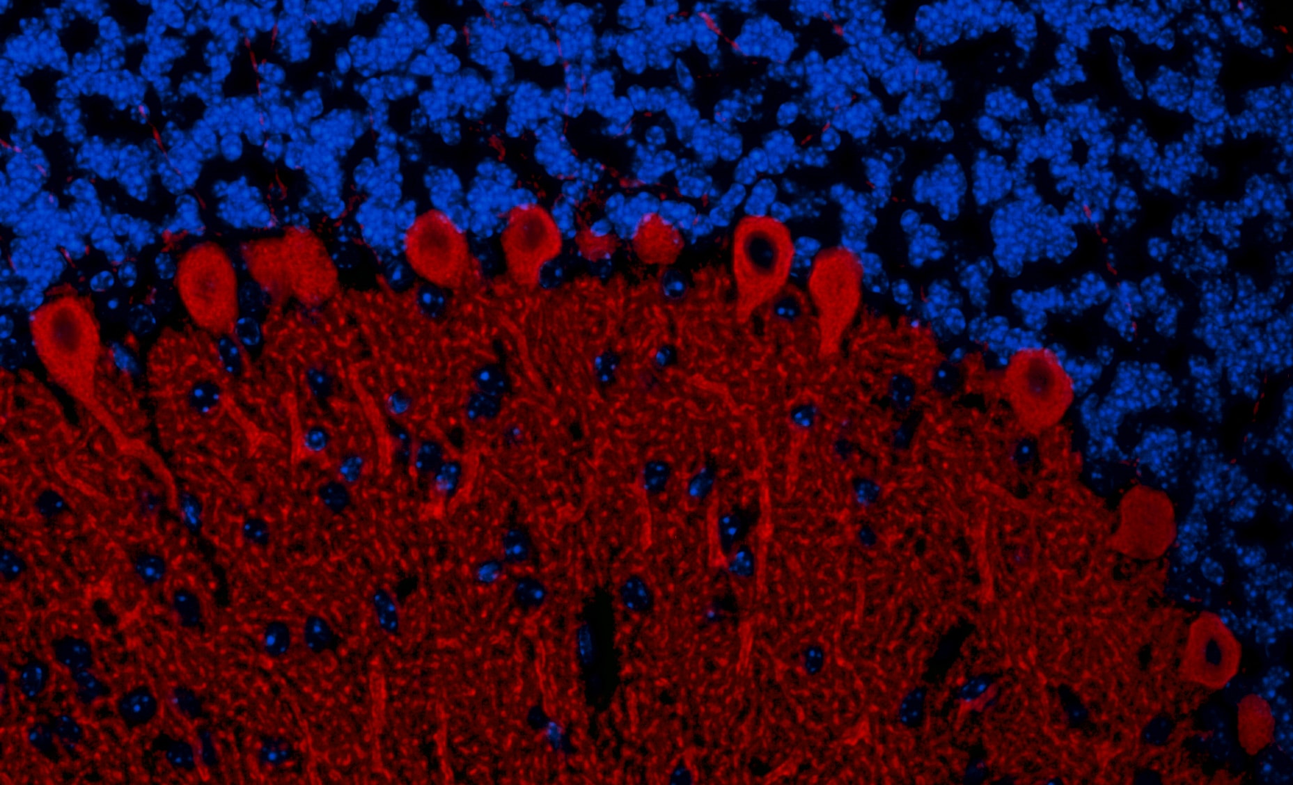 IP3R1 Antibody (A302-158A)